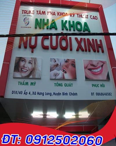 mau-mat-dung-alu-dep-phong-nha-dep_8